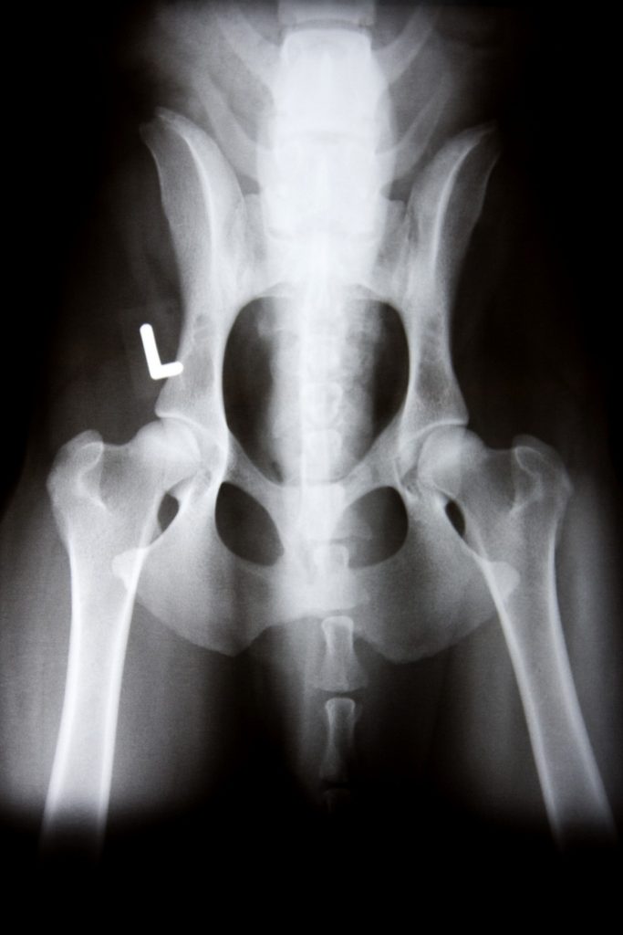 X-Rays Lincoln, CA